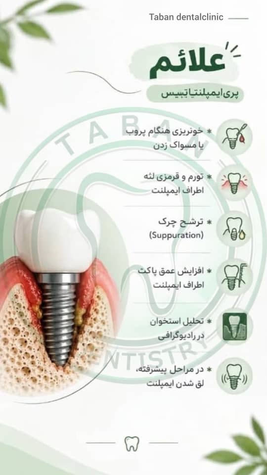 علائم پری‌ایمپلنتایتیس